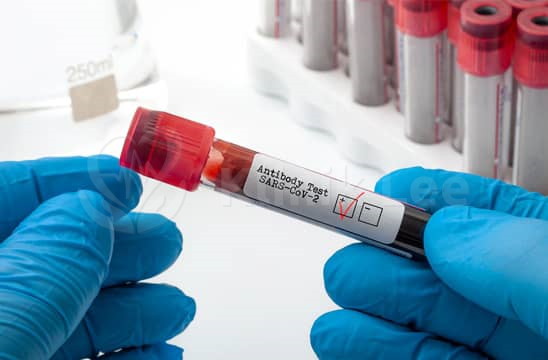  冠状病毒-19（SARS-CoV-2）组合抗体定性和定量血液检测 接种疫苗后/曾经感染过